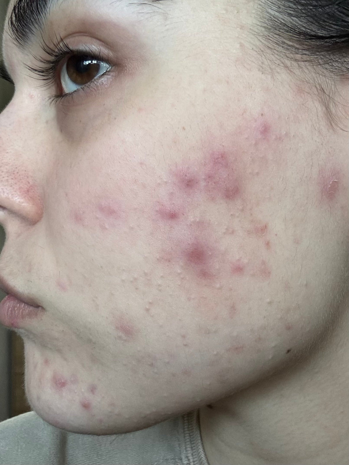 Before skincare result