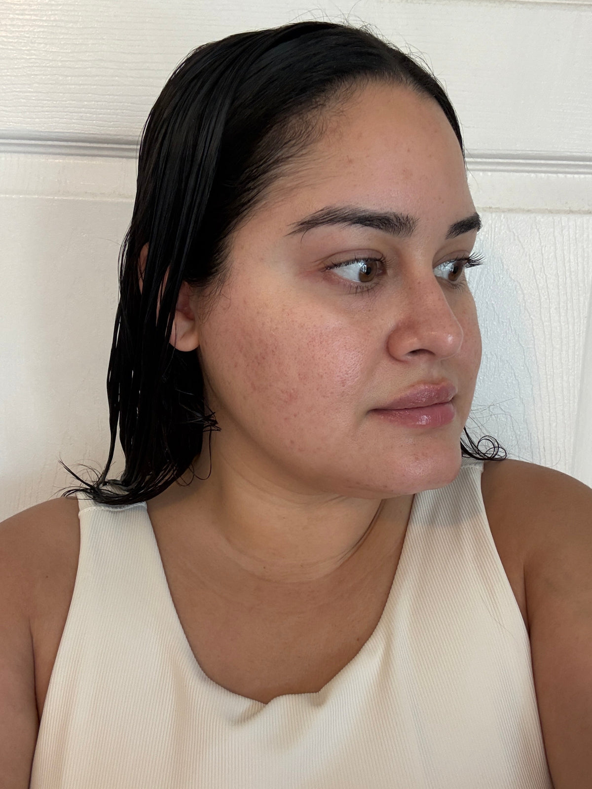 After skincare result