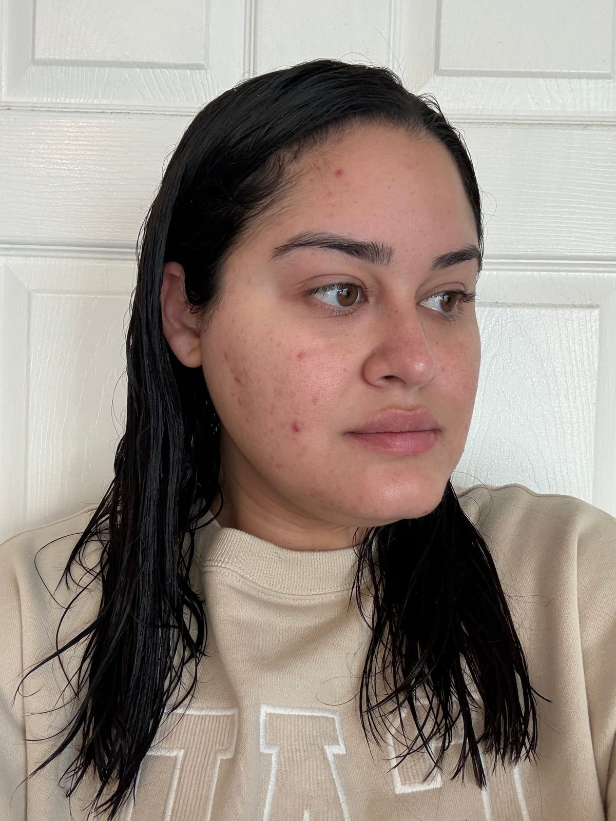 Before skincare result